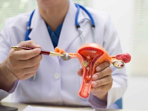 Cáncer de ovario: un seguimiento ginecológico, incluso después de la