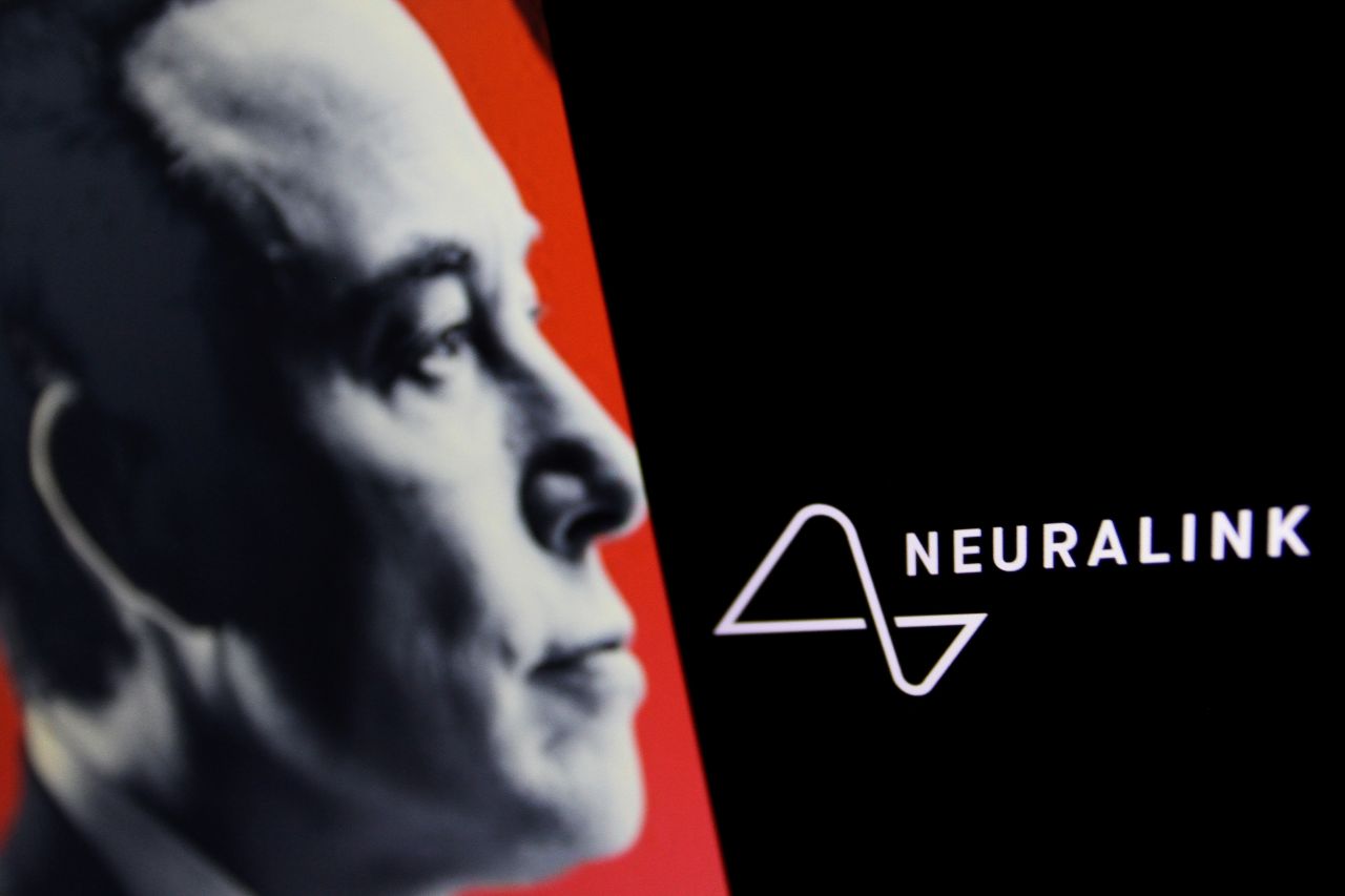 El primer paciente de Neuralink cuenta su historia 18 meses
