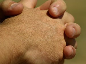 «No es contagioso»: despedido de McDonald's por sudar de las