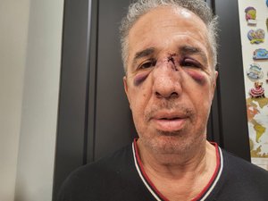 TESTIMONIOS. "Me insultaron, me escupieron en la cara", "Un cabezazo