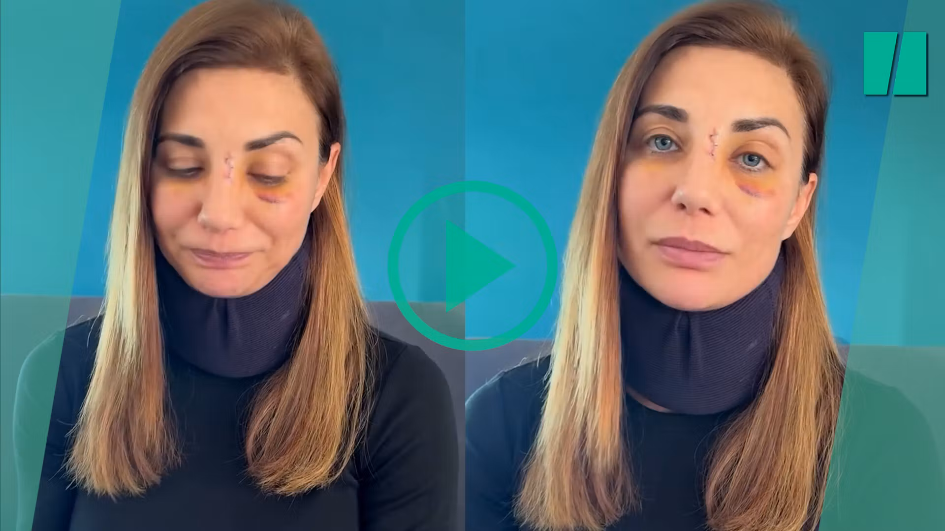 Ariane Brodier se pronuncia sobre la violenta agresión que sufrió