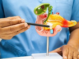 Cáncer de páncreas: pronto será el 2º cáncer más mortal