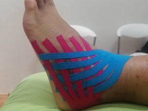 Mazamet. Cuando el taping habla del cuerpo