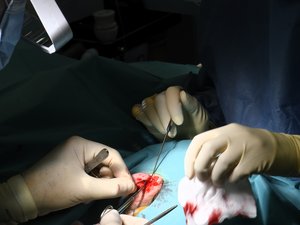 Operado de un tumor, Luc contrae una infección mortal: la