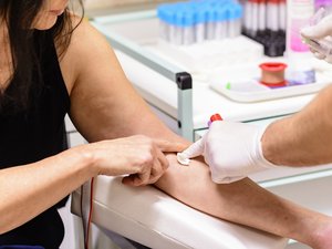 VIH: diagnósticos aún demasiado tardíos en Europa