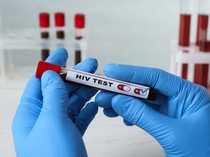 VIH: más de 5,000 contagios en Francia en 2024