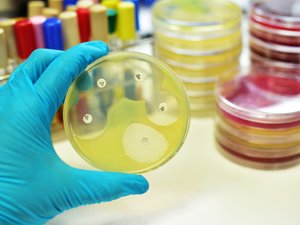 ¿Qué significa la antibiorresistencia y por qué es preocupante su