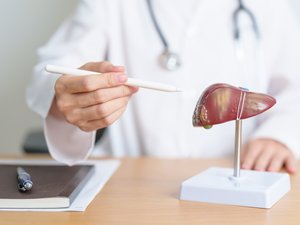 Enfermedad del hígado graso: una pandemia desconocida para los franceses