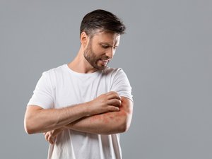 Seis nuevos biomédicos en la dermatitis atópica, ¿para quién?