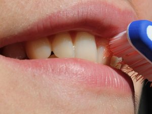 Su hijo deja de cepillarse los dientes durante seis meses: