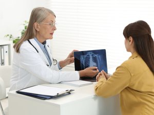 Cáncer de pulmón: ¿qué es Impulsion, el programa piloto de