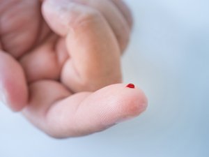 Enfermedad de Alzheimer: un simple análisis de sangre podría cambiar