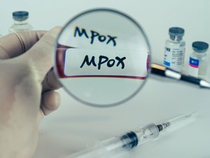 Mpox: el origen de la viruela del simio... ¡no sería