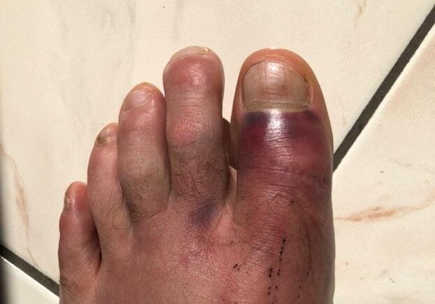 «Tienen los pies realmente horribles, es espeluznante»: por qué los