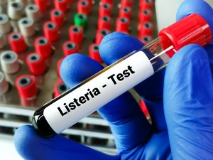 12 casos de listeriosis, 2 mortales en Francia: ¿qué hay