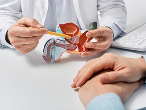 Cáncer de próstata: un tratamiento menos agresivo ahora cubierto por