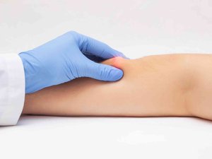 Bulto de grasa bajo la piel: ¿deberíamos preocuparnos por un