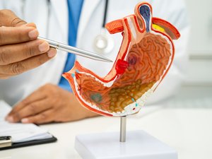 Cáncer de estómago: movilización mundial para detectar y tratar la