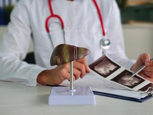 Fibrosis hepática: 1,5 % de los adultos ignoran que están