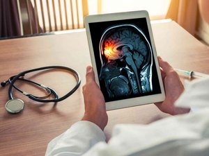 Meningitis: un flagelo mundial que avanza demasiado lento