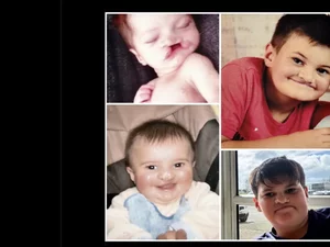 Élan de solidaridad por Maé, 13 años, afectado por una