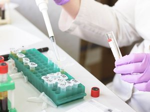 Obesidad: cómo un comprimido y una nueva molécula pretenden competir