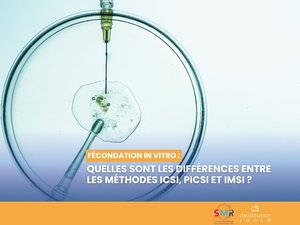 Fecundación in vitro: ¿cuáles son las diferencias entre los métodos