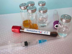 Hantavirus: hace 1 año, ya se hablaba de él