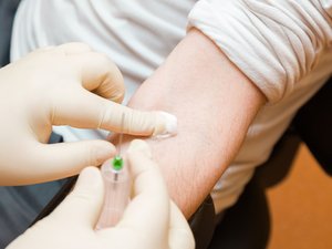 Cáncer de pulmón: una prueba de sangre para mejorar la