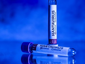 DIRECTO. Hantavirus en un barco de crucero: la francesa contagiada