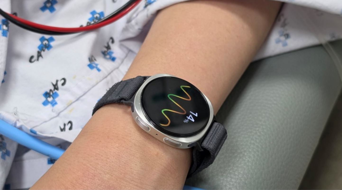 El Galaxy Watch ahora puede predecir un malestar vagal "con