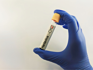 Hantavirus: lo que nos enseña el estudio de una epidemia