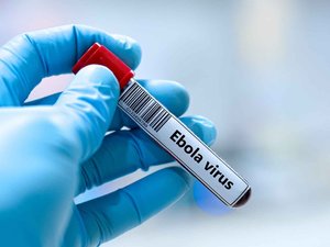 Ébola: un primer caso detectado en Francia
