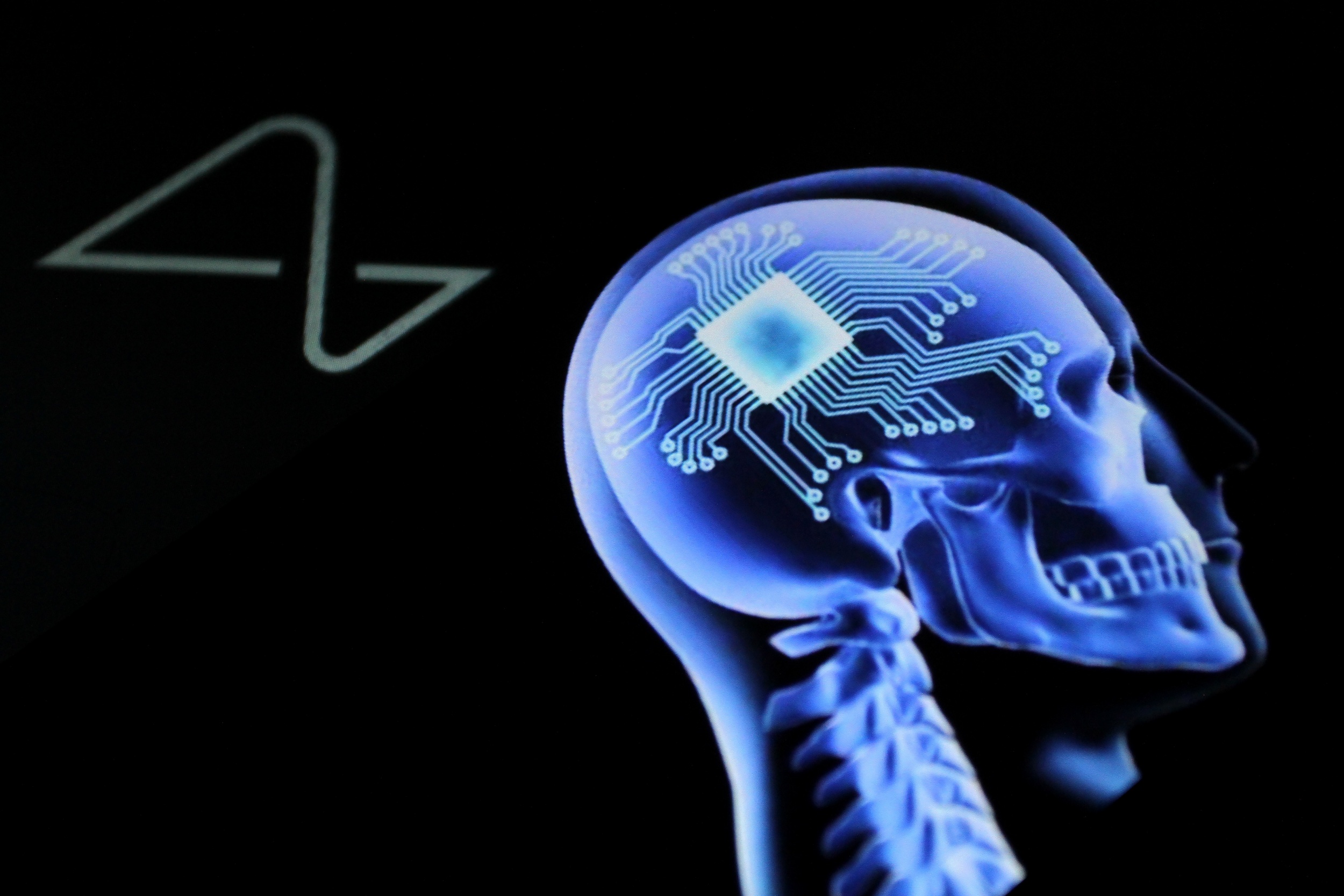 China adelanta a Neuralink con un chip cerebral ya reembolsado