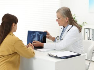 Un tratamiento demuestra su eficacia contra un cáncer de pulmón