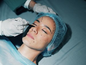 Cirugía estética: reconocer la adicción…
