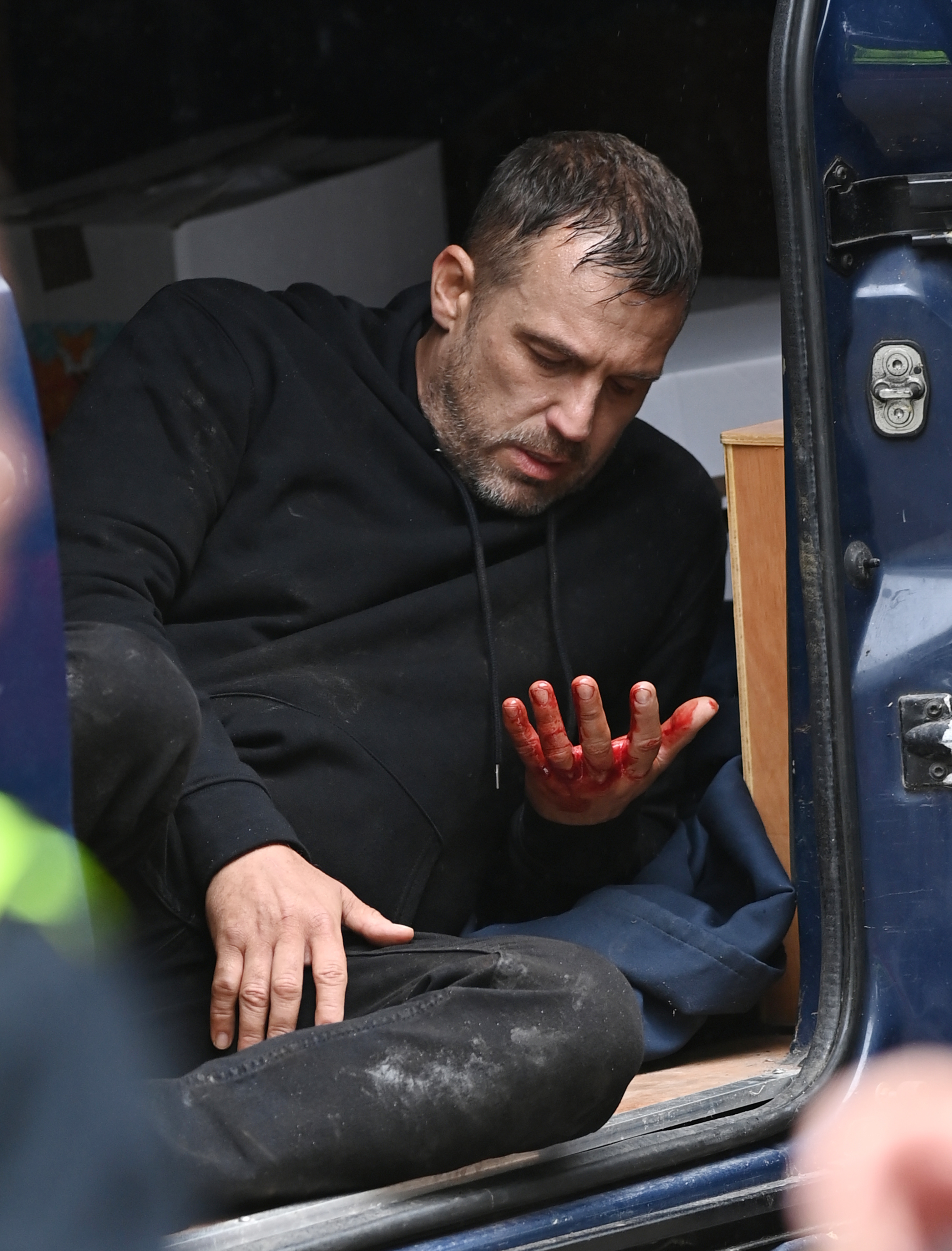 La main de l'acteur Jamie est couverte de sang