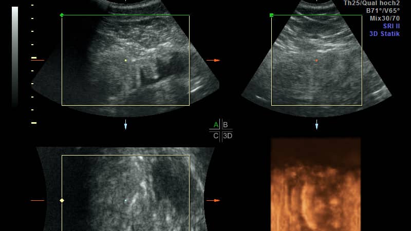 Les images échographiques que tout le monde attendait : Le panda est enceinte !