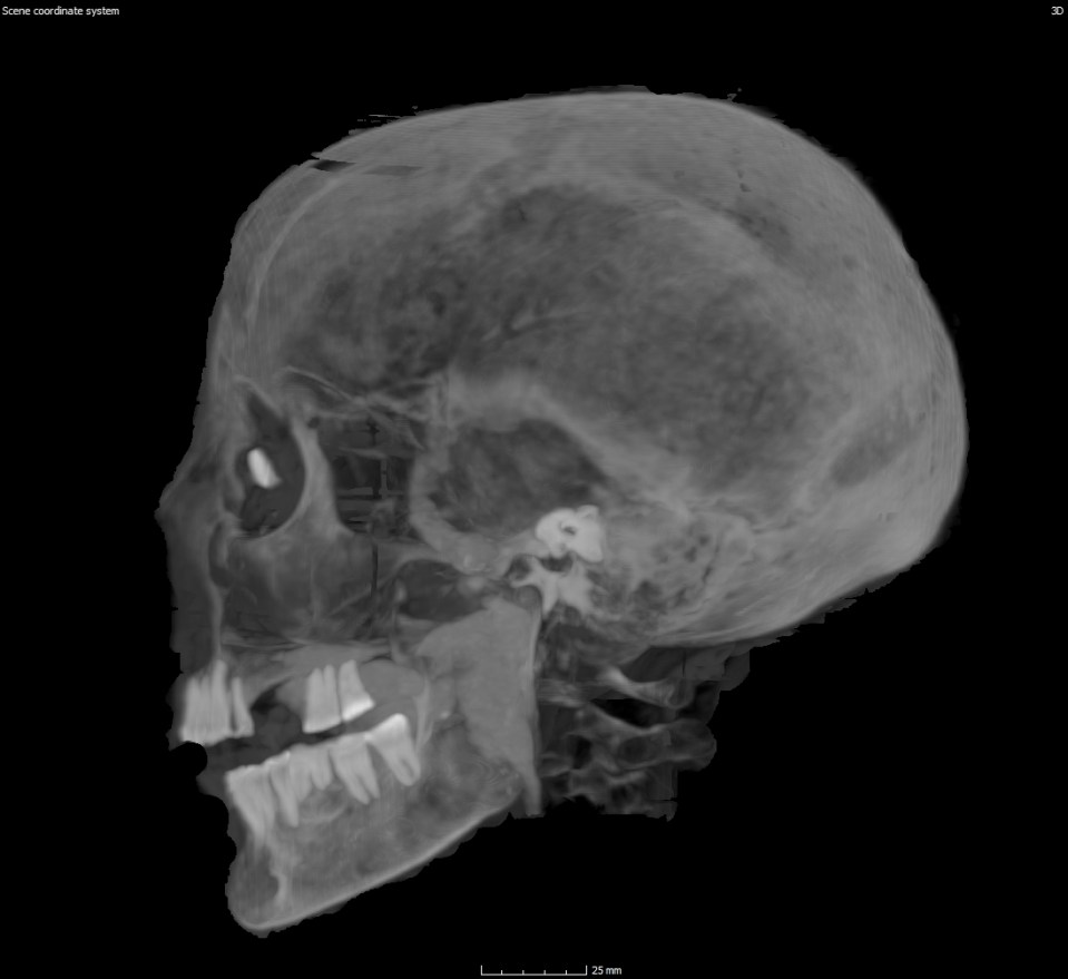 Chenet-aa avait également des yeux artificiels fabriqués à partir d'un matériau inconnu placés dans ses orbites pour s'assurer qu'ils l'accompagneraient dans l'au-delà.