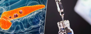 Le cancer chez les moins de 50 ans ne cesse de croître depuis des décennies. Une méta-analyse désigne enfin le principal responsable : le vieillissement biologique.