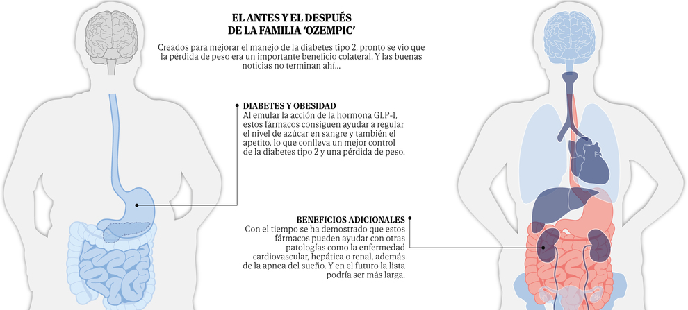 Protéger le muscle pendant les traitements avec des médicaments de la ‘famille Ozempic’ : une nouvelle alternative à l’horizon