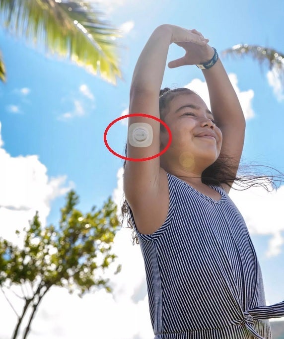 Dexcom G7 sensörü kolun arkasına takılıyor - Apple Watch artık size neredeyse gerçek zamanlı kan şekeri ölçümleri gösterebiliyor, ancak büyük bir sorun var