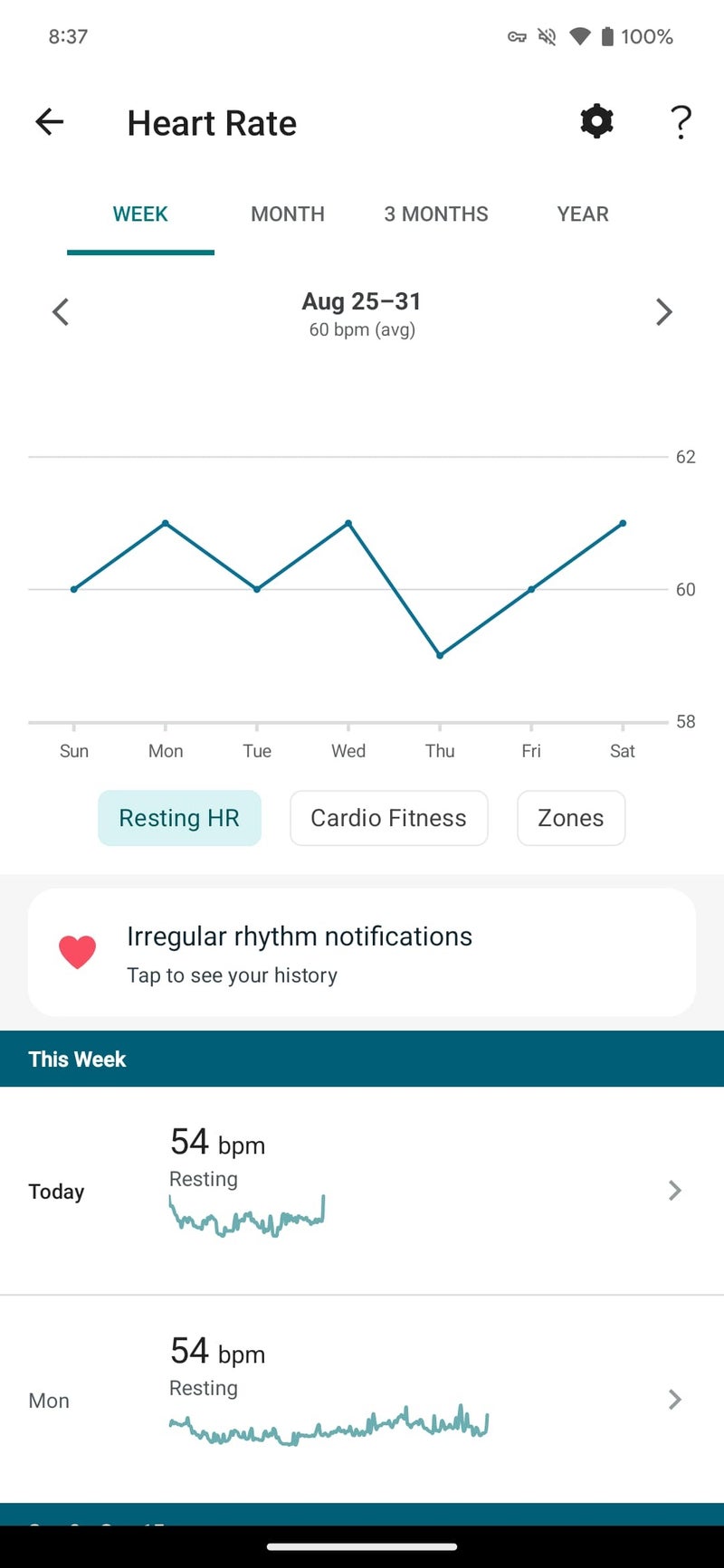 Eski Fitbit kalp atış hızı veri sayfasının ekran görüntüsü