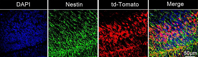 Genetik materyalin fetal beyin hücrelerine iletilmesi için bir yöntem geliştirildi: Araştırma, genetik beyin hastalıklarının tedavisinin yolunu açıyor