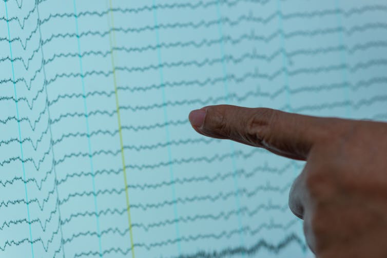 EEG okumasına işaret eden parmak
