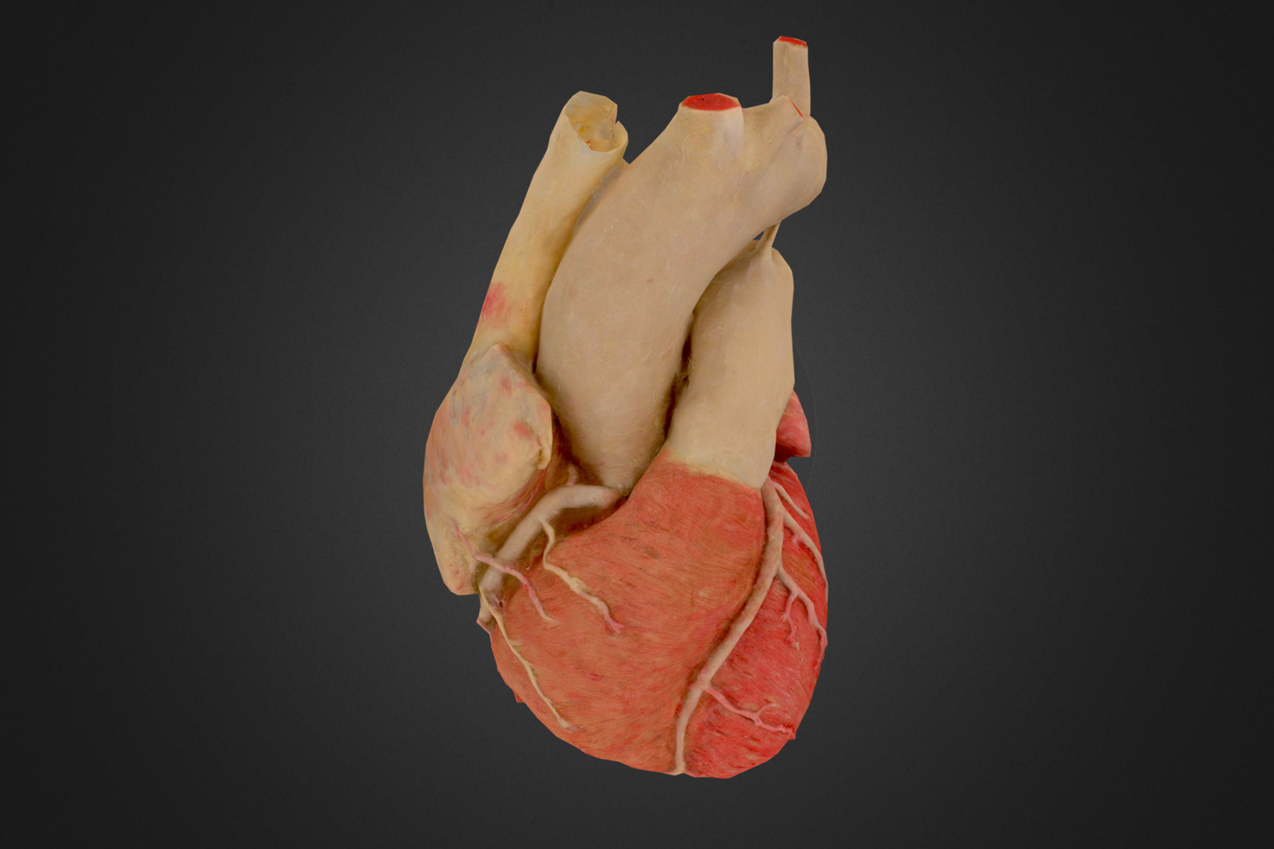 NYU Langone Health tarafından yaratılan bir kalbin 3D sürükleyici modeli.
