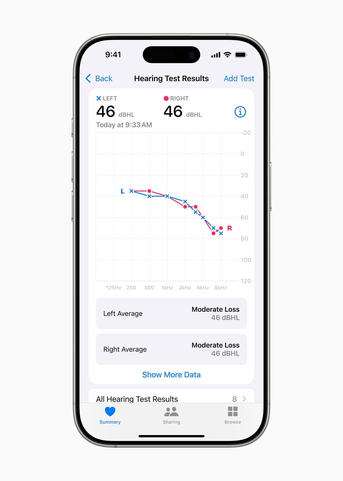 Ayrıca işitme testi sonuçlarınızın anlaşılması kolay bir grafiğini de elde edersiniz. | Apple'a görüntü kredisi. - AirPods Pro 2 İşitme cihazı özelliği nihayet İngiltere'de geliyor