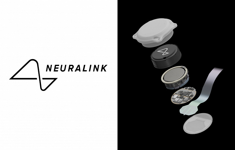 Nevralink Ilona Mask 2025'te Vizyonu İlk Kör Adam'a geri döndürecek. Kör şık çipler gelecekte “insanüstü görüş” sağlamalı
